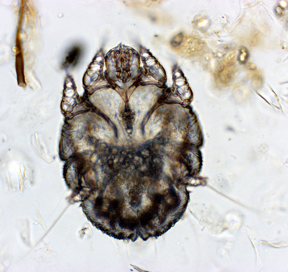 Scabies Mite Pictures