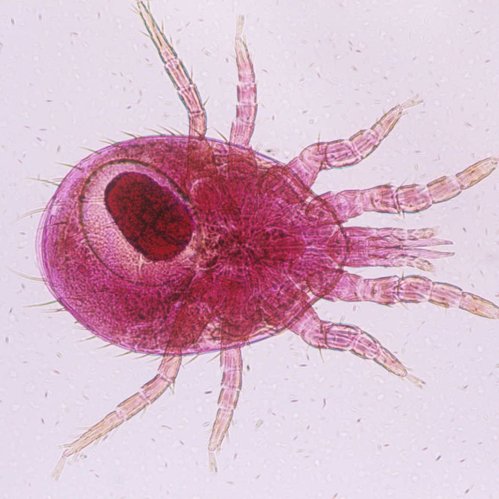 Rodent Mites Magnified