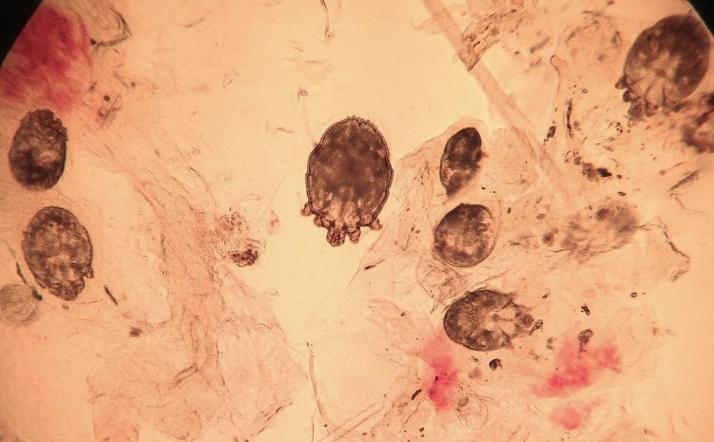Scabies Microscopic